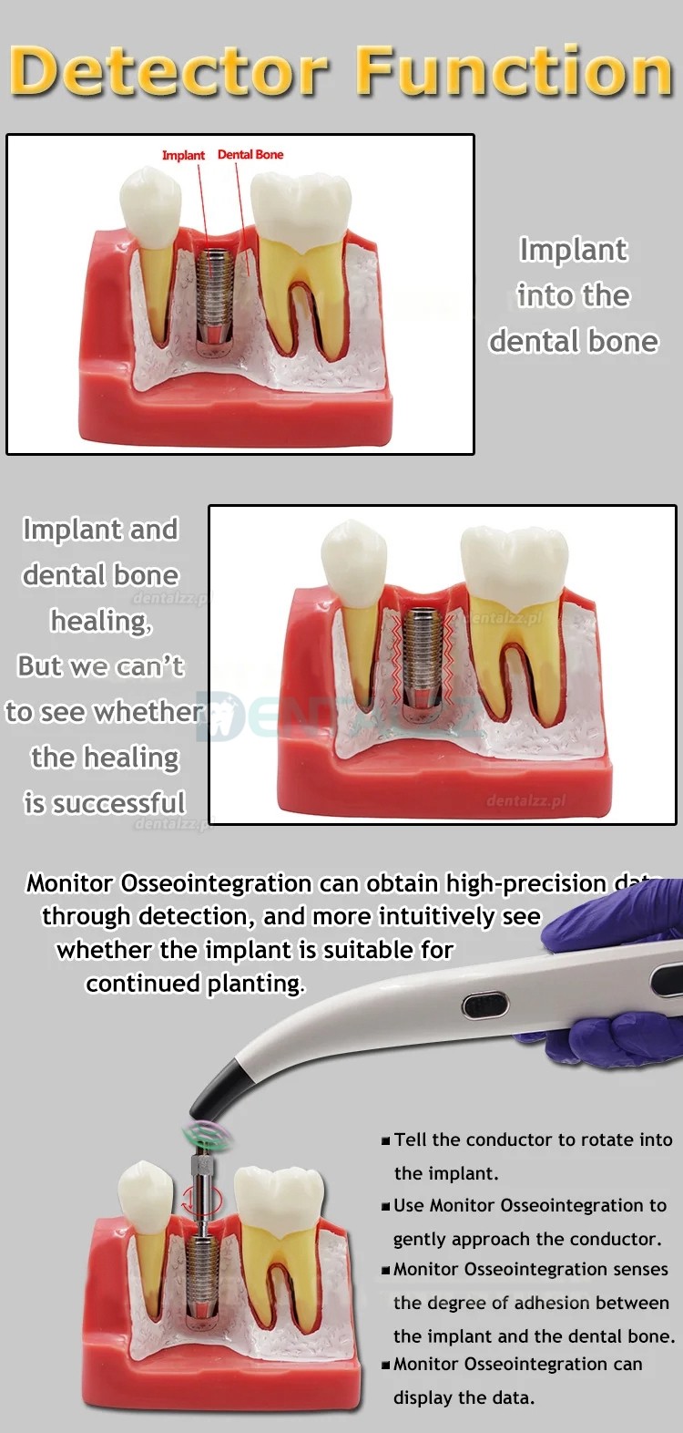 Tester stabilności implantu dentystycznego urządzenie pomiarowe miernika stabilności implantu