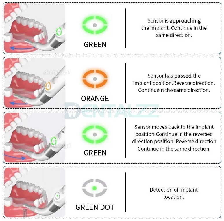 YAHOPE iD1 Detektor implantów stomatologicznych lokalizator łączników implantów Czujnik obrotowy 360°